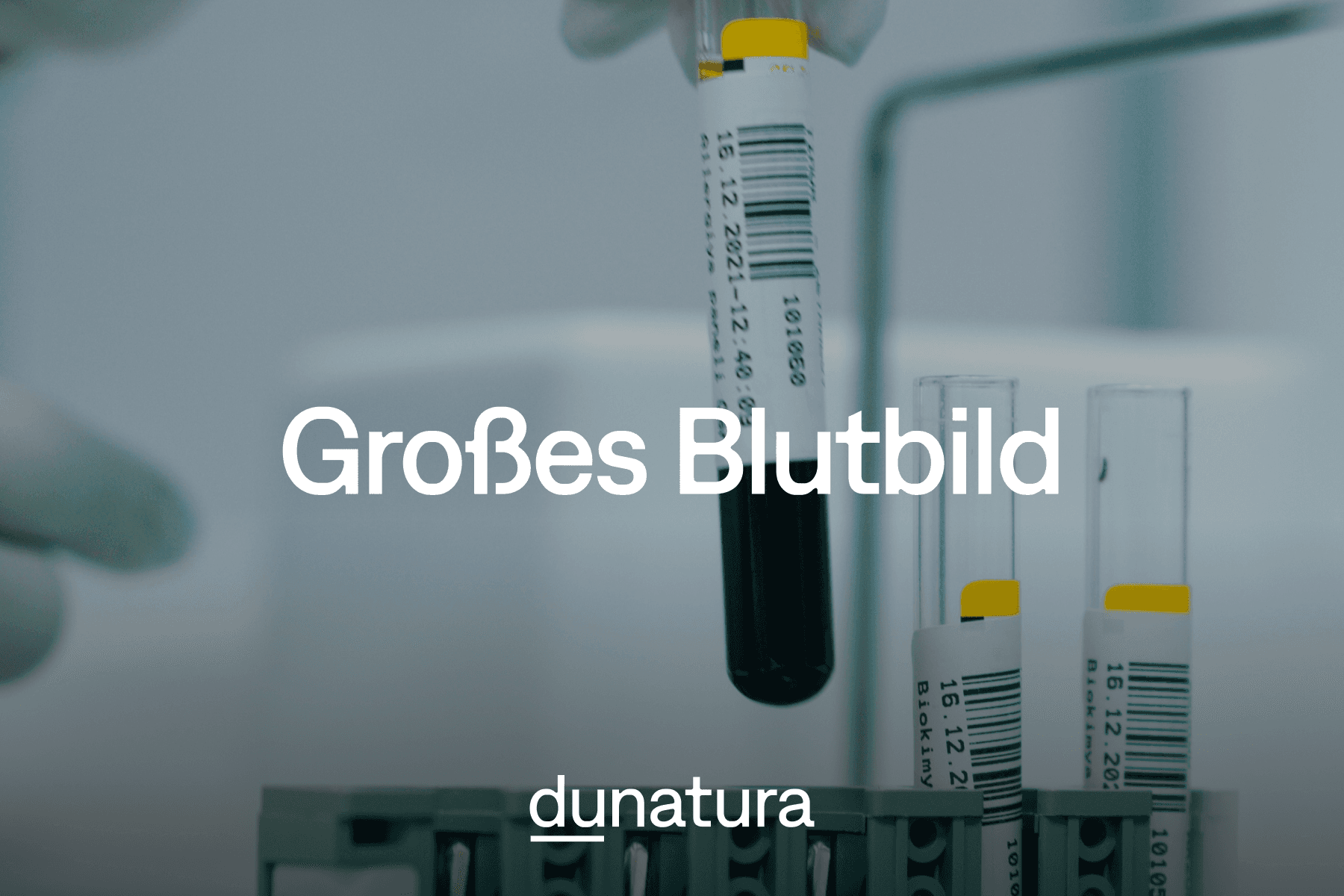 Großes Blutbild beim Arzt: Welche Werte zeigt es - und welche nicht?